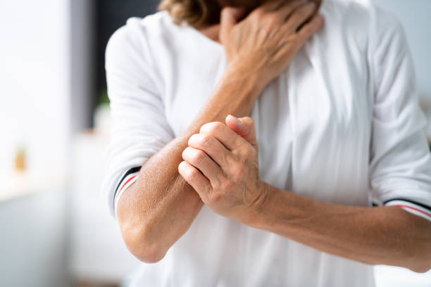 istock Woman Scratching Itching Body Skin 1405792864