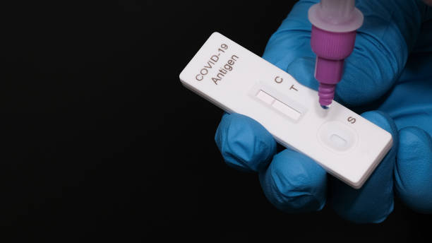 Surgical gloves, placing the sample into the covid-19 antigen diagnostic test device, Physician who owns a COVID-19 antigen test kit with a COVID-19 2019-nCoV viral disease test kit, Rapid COVID-19. guantes quirúrgicos, colocando la muestra en el dispositivo de prueba de diagnóstico de antígeno covid-19, médico que posee un kit de prueba de antígeno covid-19 con un kit de prueba de enfermedad viral covid-19 2019-ncov, rapid covid-19.