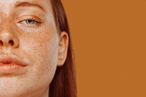 Retrato en primer plano de la mitad de la cara de una chica pelirroja con pecas photo