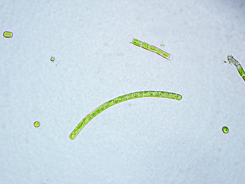 This is a photomicrograph of Spirogyra magnified 100 times.