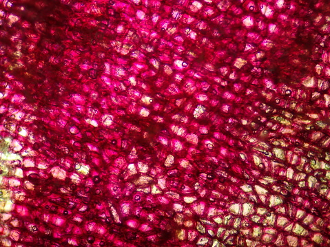 This is a photomicrograph of the skin of a sweet potato magnified 100 times.