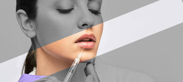 correction de la forme des lèvres féminines, concept. lèvres pulpeuses mises en évidence d’une belle femme après une augmentation des lèvres et une procédure de correction de la forme - dermal fillers photos et images de collection