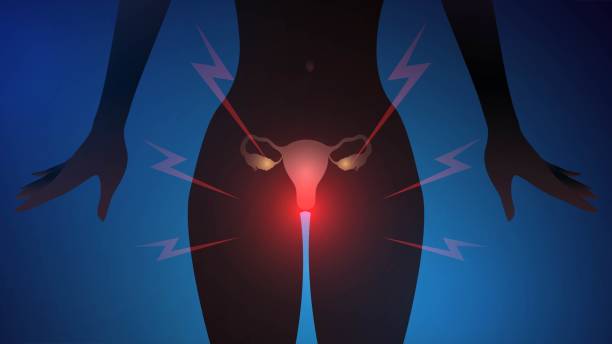 Gynecological disease vector art illustration