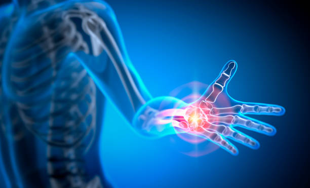 istock Pain in Hand Joint 1406340464