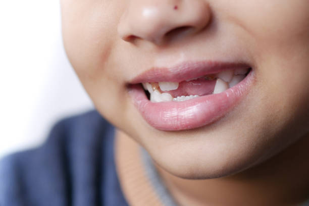 istock child girl smiling with deformed teeth 1406439554