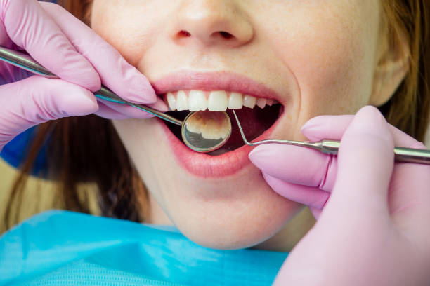 istock Dental drilling procedure and check up on beautiful teeth and open mouth 1406519394