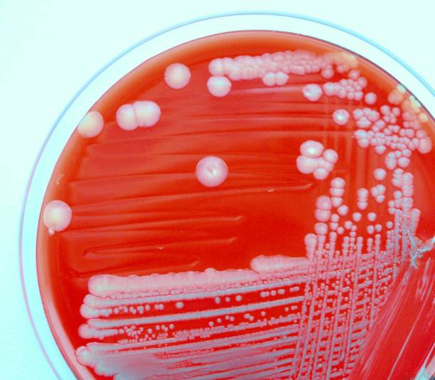 腸内毒素原性大腸菌(etec) - blood agar ストックフォトと画像