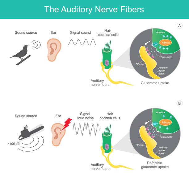 聴覚神経線維としては、ヒトの脳に影響を与える聴覚神経線維に信号音が送られている比較音源2種類がある。 - auditory cortex点のイラスト素材／クリップアート素材／マンガ素材／アイコン素材