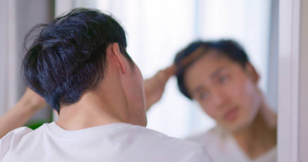 istock man worried about hair loss 1406645387