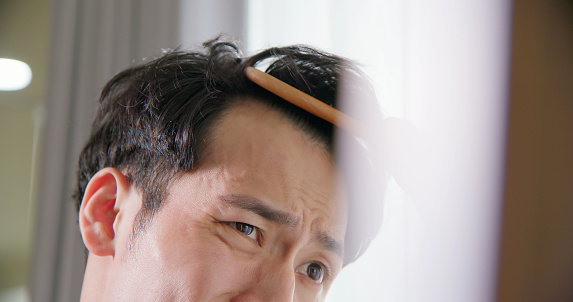 close up of asian man worried for hair loss and looking at mirror combing his receding hairline with brush