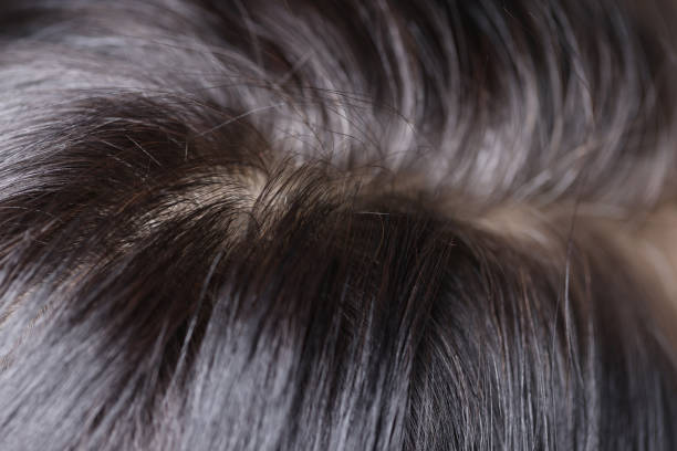 istock Black and gray hair on head closeup 1406862282
