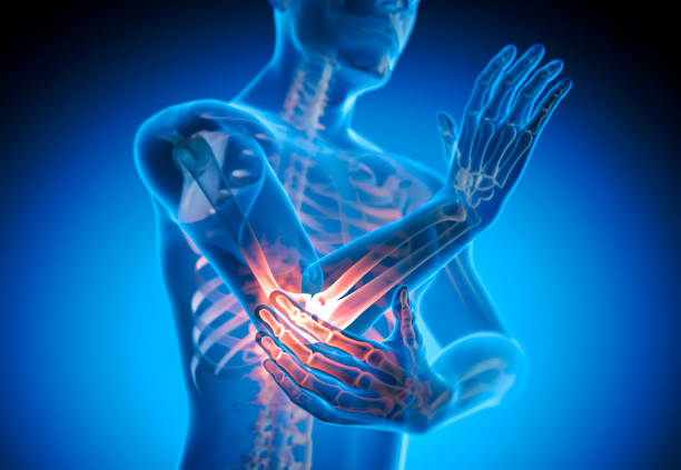 istock Pain in ellbow joint 1407159239