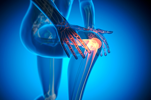 Medical X-Ray illustration of pain in knee joint - 3D illustration