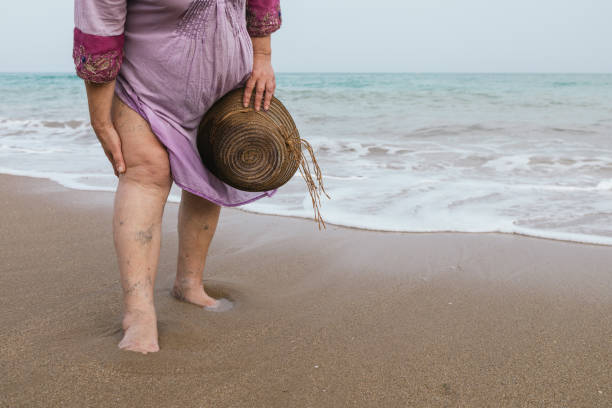 unrecognizable curvy senior woman with varicose veins on her legs wearing a purple dress, sunglasses and hat on the beach during her summer vacation.horizontal photo with copy space. unrecognizable curvy senior woman with varicose veins on her legs wearing a purple dress, sunglasses and hat on the beach during her summer vacation.horizontal photo with copy space. spider veins stock pictures, royalty-free photos & images