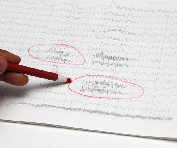 ergebnisse eines elektroenzephalogramms nach einer neurophysiologischen untersuchung, d.h. der aufzeichnung der bioelektrischen aktivität des gehirns in ruhe, wachzustand oder schlaf, die mit elektroenzephalographie durchgeführt wird - eeg epilepsy science electrode stock-fotos und bilder