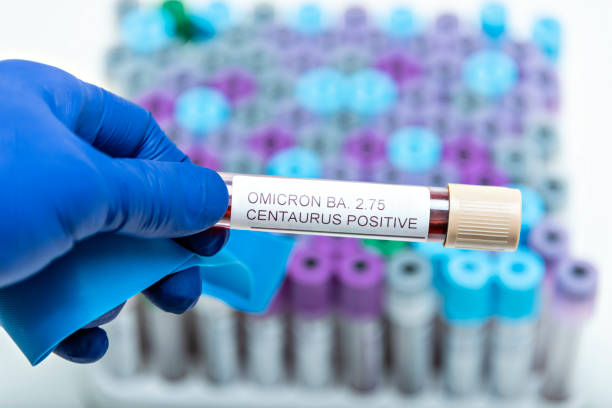 Positive blood infection sample in test tube for CENTAURUS BA 2.75 omicron covid19 coronavirus in lab. Scientist holding to check and analyze for patient in hospital. stock photo