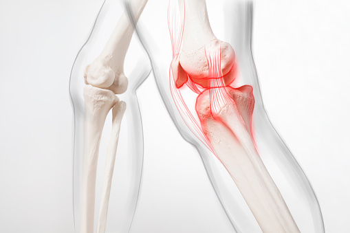 Pierna humana, menisco de rodilla, representación médicamente precisa de una articulación artrítica de la rodilla photo