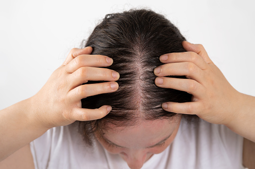 Mujer controla la caída del cabello y poco volumen con hai fino photo