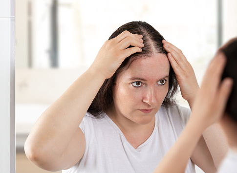 La mujer controla la caída del cabello photo