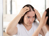 istock Woman controls hair loss 1407675558