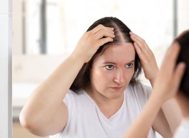 Woman controls hair loss Woman controls hair loss and unhappy gazing at you in the mirror hair loss stock pictures, royalty-free photos & images