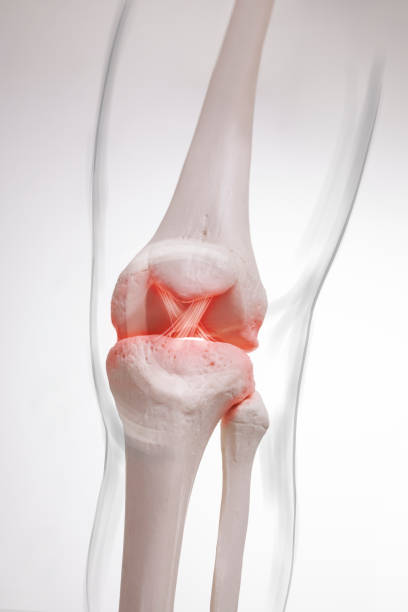 istock Human leg,  knee meniscus, medically accurate representation of an arthritic knee joint 1407718711
