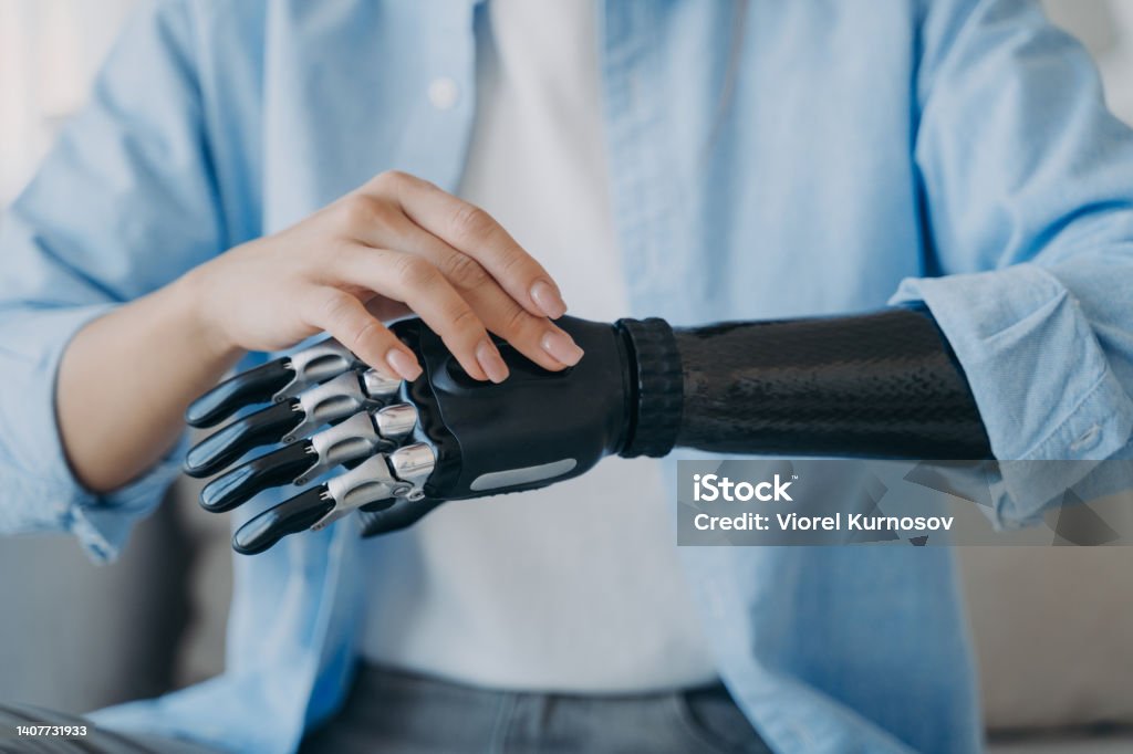 Cyber hand of female amputee. Disabled woman is changing settings of robotic prosthesis. Cyber hand of female amputee. Disabled woman is changing settings of bionic arm. Electronic sensor hand has processor and buttons. High tech carbon robotic prosthesis. Medical technology and science. Prosthetic Equipment Stock Photo