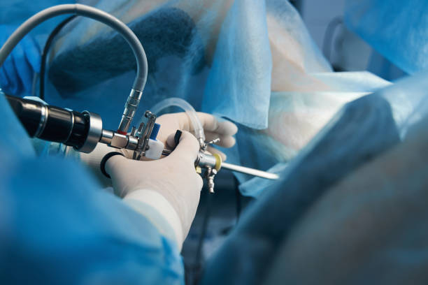 Unrecognizable woman undergoing hysteroscopy in the clinic Close up photo of a medical worker in latex gloves standing with a hysteroscope near the patient spinous process stock pictures, royalty-free photos & images