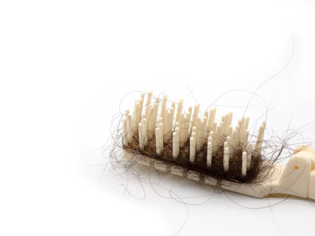 istock White comb with hair loss 1407863951