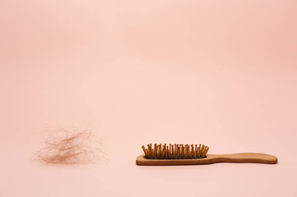 istock hair loss 1407869024