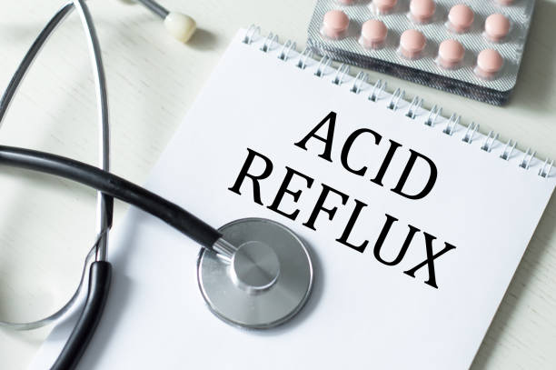 istock ACID REFLUX text on a white notebook on the table next to the stethoscope and tablet in packages. Medical concept. 1408107594