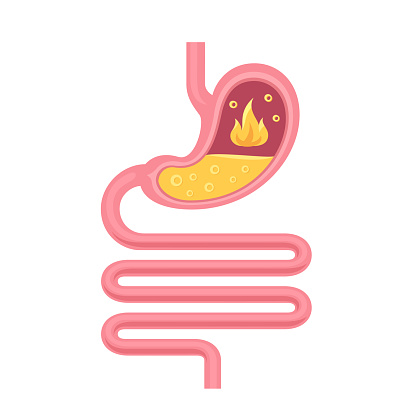Acid reflux, pyrosis or heartburn concept. Human stomach anatomy. Gastrointestinal tract and digestive system.
