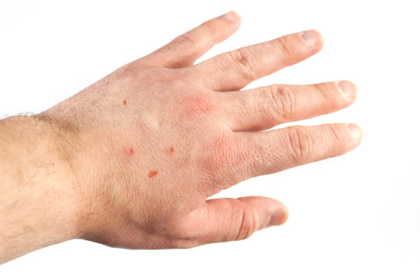 istock Young caucasian man hand with irritation on isolated white background. 1408253660