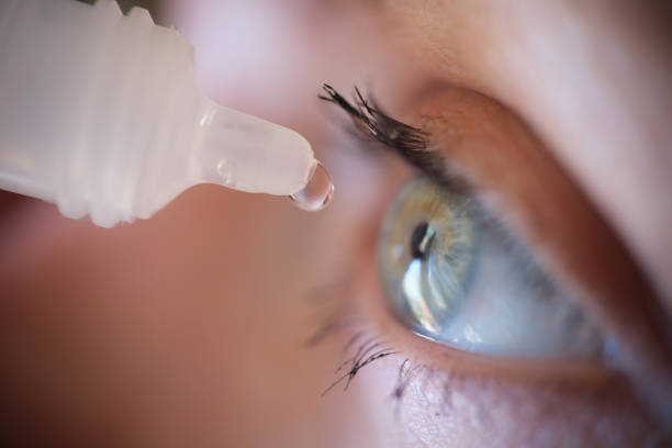 Woman dripping drops from plastic bottle into her eyes closeup Woman dripping drops from plastic bottle into her eyes closeup. Allergic conjunctivitis treatment concept saline drip stock pictures, royalty-free photos & images