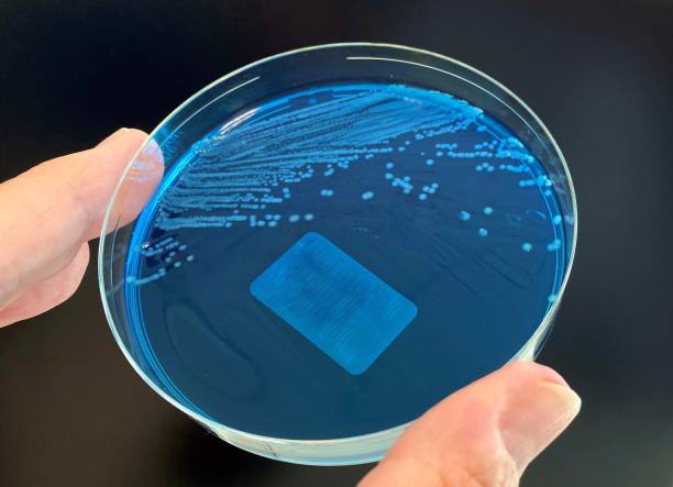 enteroinwazyjna escherichia coli (eiec) - czerwonki zdjęcia i obrazy z banku zdjęć