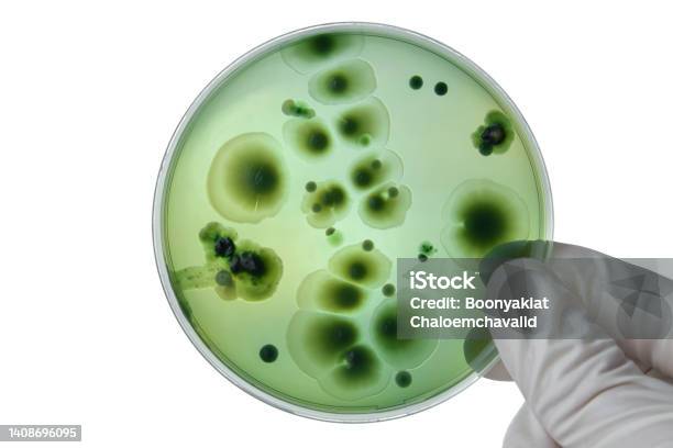 Hand With Petri Dish Or Culture Media With Bacteria On White Background With Clipping Test Various Germs Virus Coronavirus Covid19 Microbial Population Count Food Science Stock Photo - Download Image Now