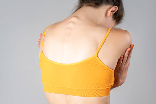 Intervertebral spine hernia, pain between the shoulder blades, woman suffering from backache, spinal disc disease