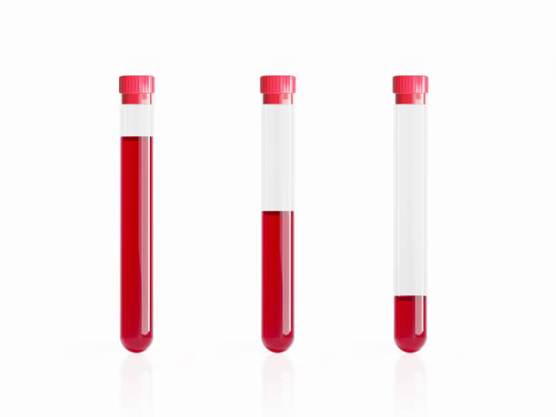흰색 배경에 혈액 튜브 - laboratory blood laboratory equipment medical sample 뉴스 사진 이미지