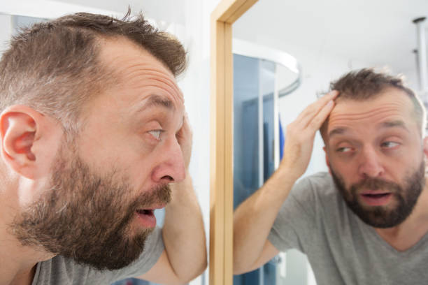 istock Worried man looking at his decreasing hairline 1408840601