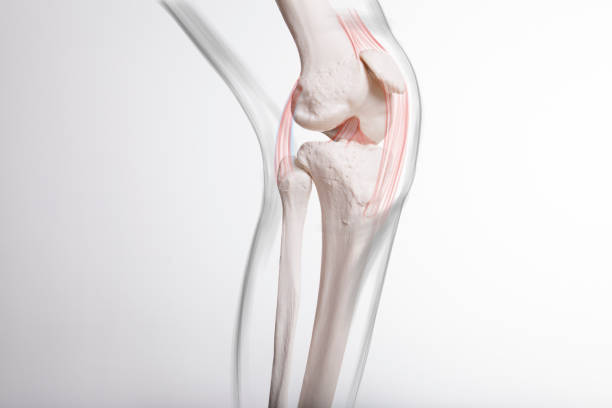 istock Human leg,  knee meniscus, medically accurate representation of an arthritic knee joint 1409073029