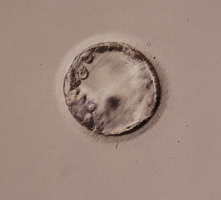 Day 6 Embryo for FET IVF