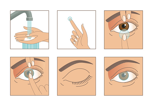 Contact lenses. Instruction how to put on lenses. 5 steps. Wash your hands, take a lens, check the position of the lens. Carefully insert the lens