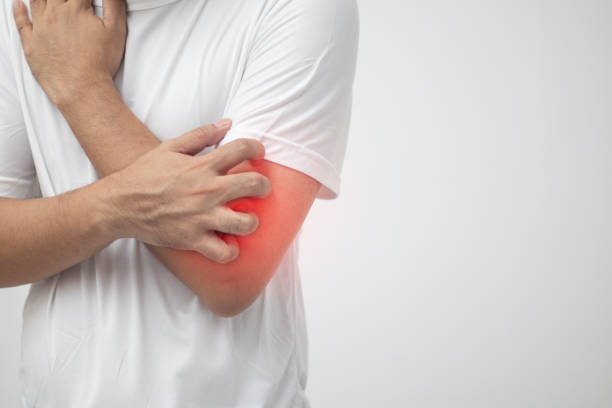 istock Skin disease concept, itching, scratching the arm 1409293912