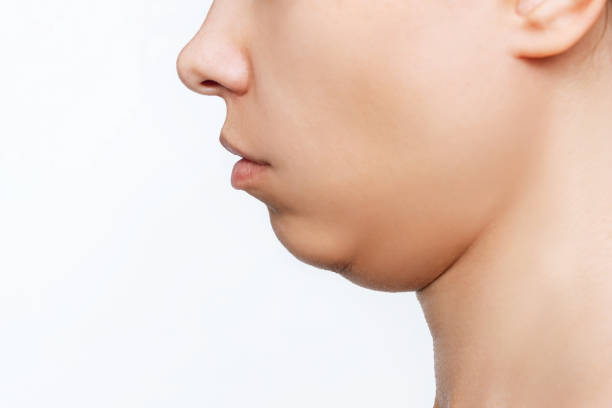 Cropped shot of a young caucasian woman's face with double chin isolated on a white background Cropped shot of a young caucasian woman's face with double chin isolated on a white background. Overweight, flabby and sagging skin. Profile chin stock pictures, royalty-free photos & images