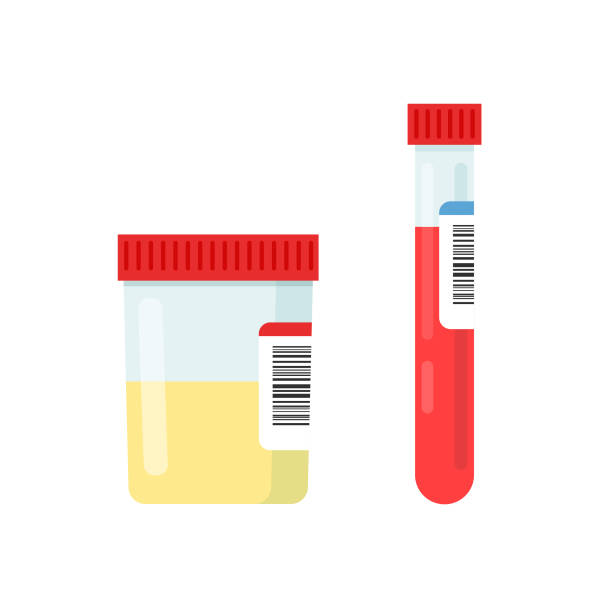 медицинские лабораторные образцы мочи и крови. - doping test stock illustrations