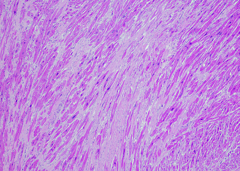 CG image of human anatomy, showing the neck and chest area, heart, lungs, major arteries and veins isolated on black background.