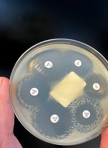 Double zones can be seen around 3 antibiotic disks. This is a clear sign of more than one bacterium being present. To measure antibiotic susceptibility for each bacterium it will be necessary to isolate E. coli and Klebsiella on separate agar plates.