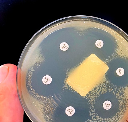 Double zones can be seen around 3 antibiotic disks. This is a clear sign of more than one bacterium being present. To measure antibiotic susceptibility for each bacterium it will be necessary to isolate E. coli and Klebsiella on separate agar plates.