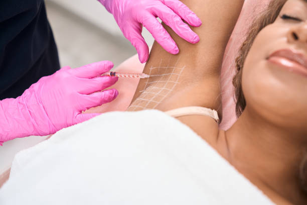 Young patient receives injections in the armpit area Young female patient with a problem of hyperhidrosis receives botulinum toxin injections in the armpit area in a cosmetology clinic sweat gland stock pictures, royalty-free photos & images