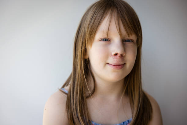 Portrait of happy Caucasian little girl looking at camera Portrait of cute little school preschool age girl standing by window at home looking at camera cleft lip stock pictures, royalty-free photos & images